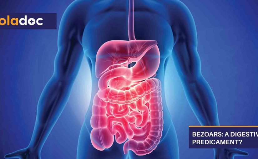 Bezoars-A-Digestive-Predicament-1-825x510