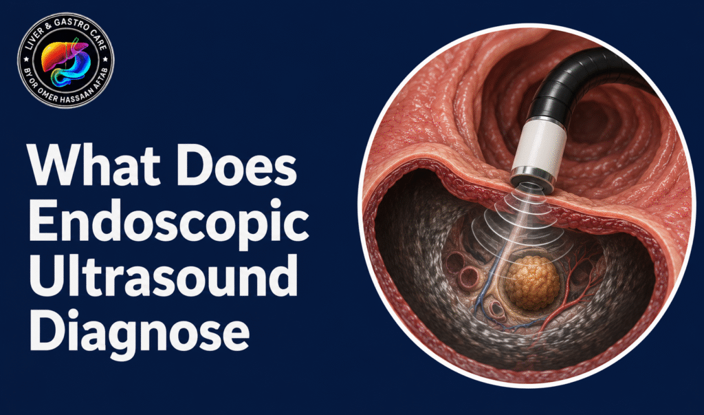 What Does Endoscopic Ultrasound Diagnose