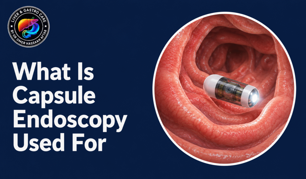 What Is Capsule Endoscopy Used For