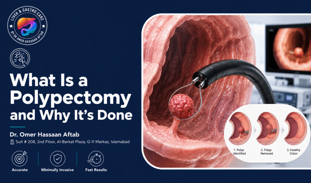 What Is a Polypectomy and Why It’s Done