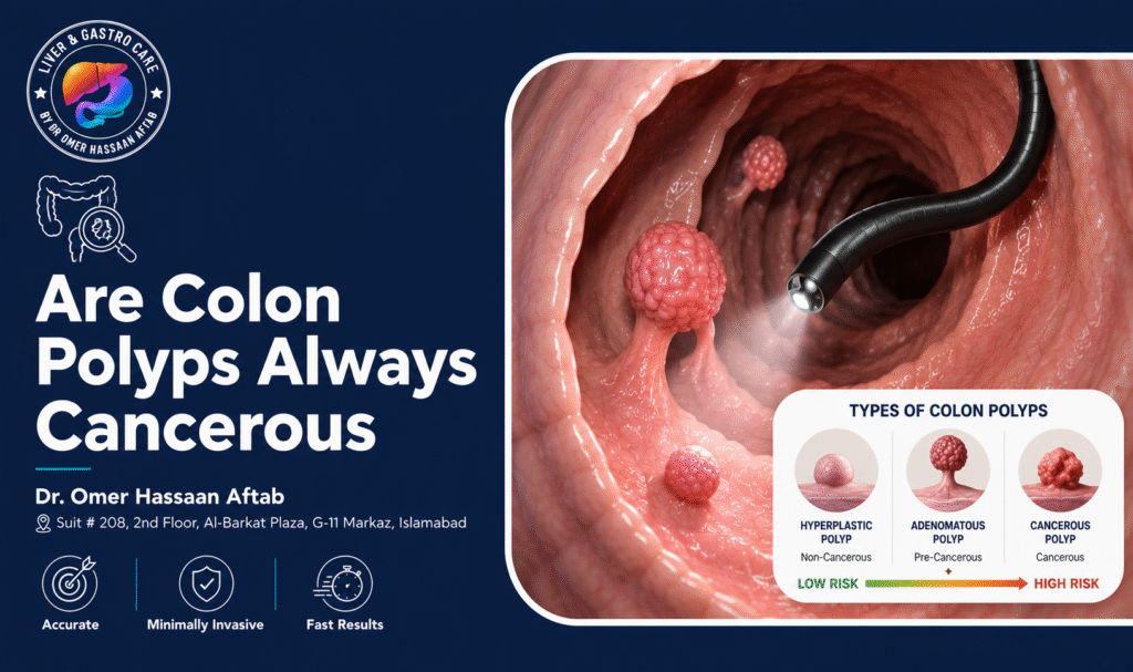 Are Colon Polyps Always Cancerous