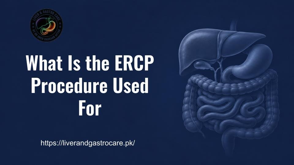 What Is the ERCP Procedure Used For