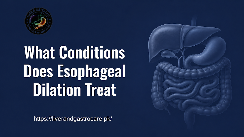 What Conditions Does Esophageal Dilation Treat