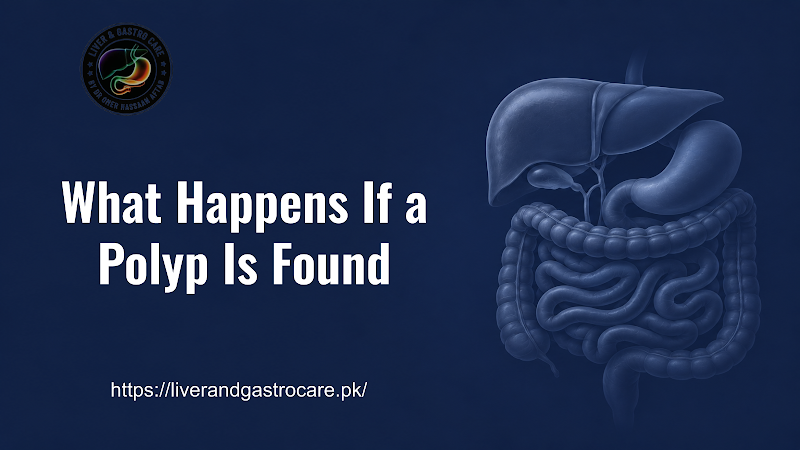 What Happens If a Polyp Is Found