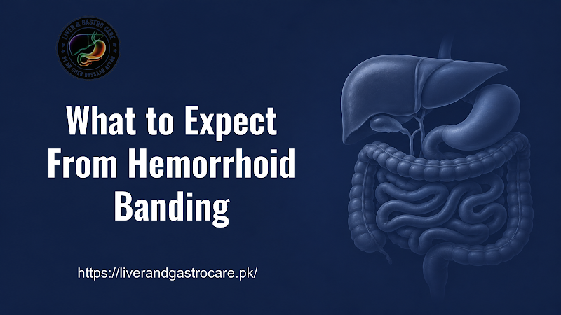What to Expect From Hemorrhoid Banding