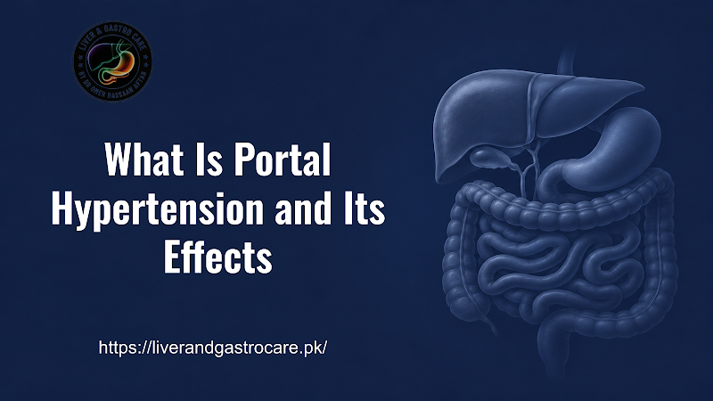 What Is Portal Hypertension and Its Effects
