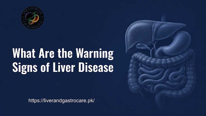 What Are the Warning Signs of Liver Disease