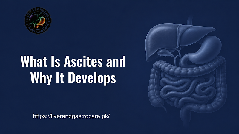 What Is Ascites and Why It Develops