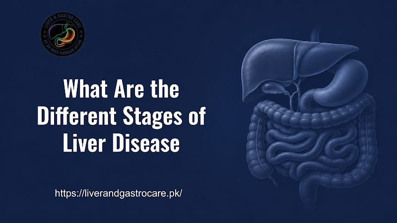 What Are the Different Stages of Liver Disease