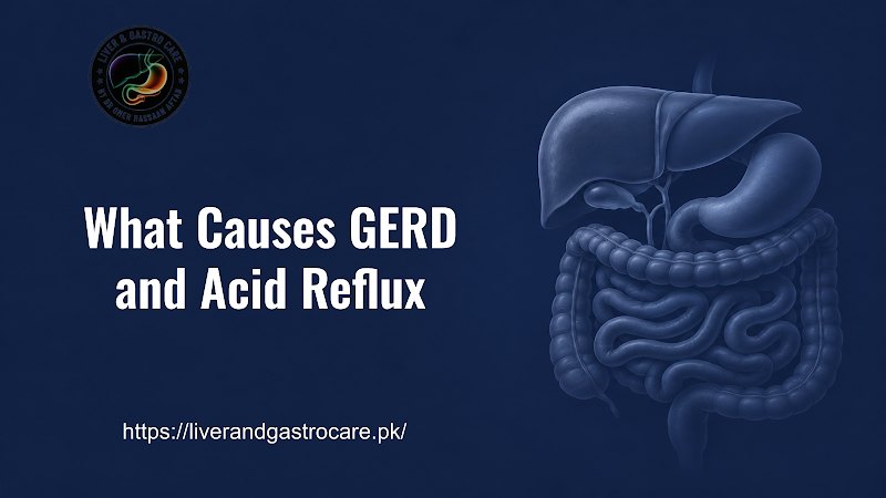 What Causes GERD and Acid Reflux