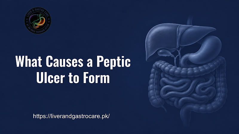 What Causes a Peptic Ulcer to Form