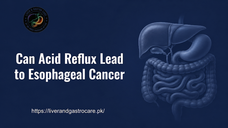 Can Acid Reflux Lead to Esophageal Cancer