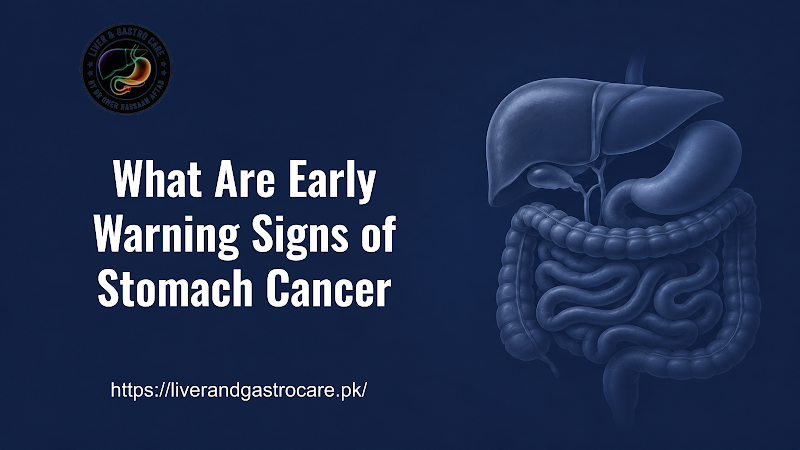What Are Early Warning Signs of Stomach Cancer