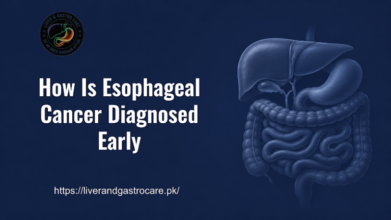 How Is Esophageal Cancer Diagnosed Early