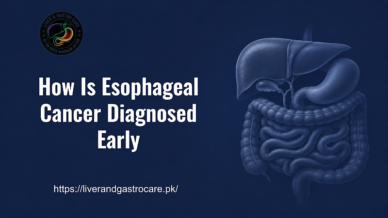 How Is Esophageal Cancer Diagnosed Early
