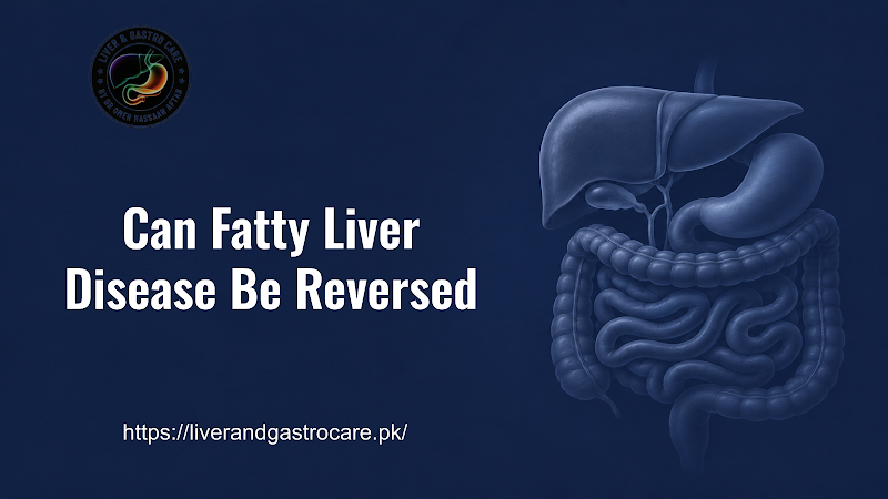 Can Fatty Liver Disease Be Reversed