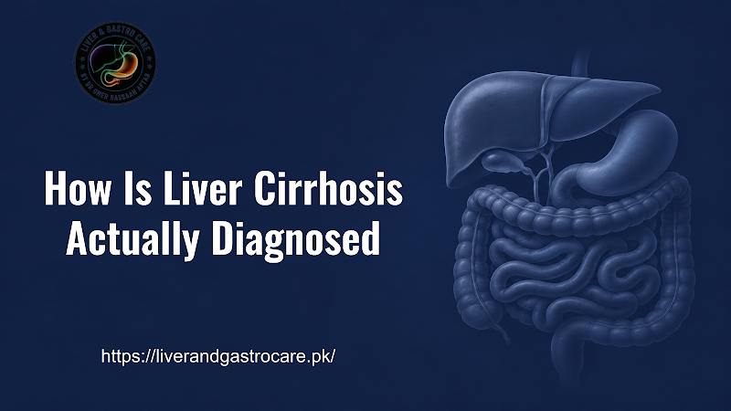 How Is Liver Cirrhosis Actually Diagnosed